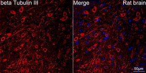 Anti-βIII-Tubulin Antibody, clone 6X6H6, Rabbit Monoclonal