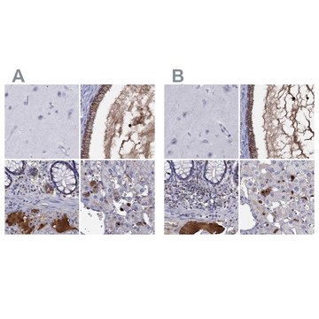 Anti-SERPINA3 antibody produced in rabbit Prestige Antibodies® Powered by Atlas Antibodies, affinity isolated antibody, buffered aqueous glycerol solution