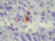 抗P物质受体抗体，疼痛 serum, Chemicon®