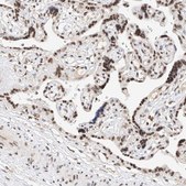Anti-NRF1 antibody produced in rabbit Prestige Antibodies® Powered by Atlas Antibodies, affinity isolated antibody, buffered aqueous glycerol solution