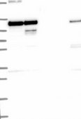 Anti-HK2 antibody produced in rabbit Prestige Antibodies® Powered by Atlas Antibodies, affinity isolated antibody, buffered aqueous glycerol solution