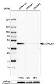 Anti-SMARCB1 antibody produced in rabbit Prestige Antibodies® Powered by Atlas Antibodies, affinity isolated antibody, buffered aqueous glycerol solution