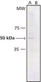 Monoclonal Anti-Phosphotyrosine antibody produced in mouse clone PT-66, ascites fluid