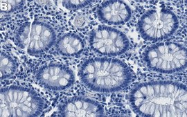 Anti-PDI Antibody, clone 1M19 ZooMAb® Rabbit Monoclonal recombinant, expressed in HEK 293 cells