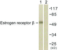 Anti-Estrogen Receptor-β antibody produced in rabbit affinity isolated antibody
