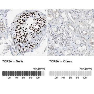 Anti-TOP2A antibody produced in rabbit Prestige Antibodies® Powered by Atlas Antibodies, affinity isolated antibody, buffered aqueous glycerol solution, Ab1