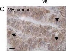 抗 β-连环蛋白 兔抗 whole antiserum