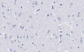 Anti-CD56 Antibody, clone 3F5 ZooMAb® Rabbit Monoclonal recombinant, expressed in HEK 293 cells