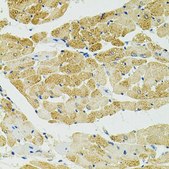Anti-RALBP1 antibody produced in rabbit