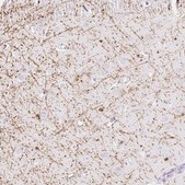 Anti-MBP antibody produced in rabbit Prestige Antibodies® Powered by Atlas Antibodies, affinity isolated antibody, buffered aqueous glycerol solution