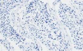 Anti-REST Antibody, clone 2E3 ZooMAb® Rabbit Monoclonal recombinant, expressed in HEK 293 cells