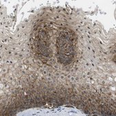 抗-ZDHHC5 兔抗 Prestige Antibodies® Powered by Atlas Antibodies, affinity isolated antibody, buffered aqueous glycerol solution