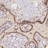 Anti-GAB2 antibody produced in rabbit Prestige Antibodies® Powered by Atlas Antibodies, affinity isolated antibody, buffered aqueous glycerol solution