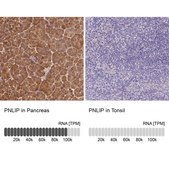 Anti-PNLIP antibody produced in rabbit Prestige Antibodies® Powered by Atlas Antibodies, affinity isolated antibody, buffered aqueous glycerol solution