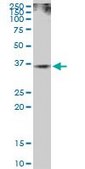 Anti-RAD51 antibody produced in mouse purified immunoglobulin, buffered aqueous solution