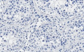 Anti-PRRX1 Antibody, clone 1L16 ZooMAb® Rabbit Monoclonal recombinant, expressed in HEK 293 cells