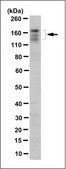 Anti-ABCB11 Antibody, clone 10D4.1 clone 10D4.1, from mouse