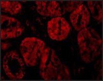 Anti-XIAP antibody produced in rabbit affinity isolated antibody, buffered aqueous solution