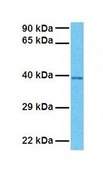 Anti-TXNIP antibody produced in rabbit affinity isolated antibody