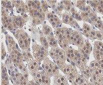 Anti-HOIP (RNF31) Antibody, clone 1CB2 clone 1CB2, from mouse