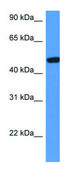 Anti-HEXA (C-terminal) antibody produced in rabbit affinity isolated antibody
