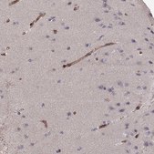 Anti-LAMB2 antibody produced in rabbit Prestige Antibodies® Powered by Atlas Antibodies, affinity isolated antibody, buffered aqueous glycerol solution