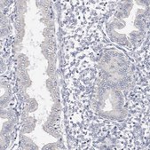 Anti-CYP2E1 antibody produced in rabbit Prestige Antibodies® Powered by Atlas Antibodies, affinity isolated antibody, buffered aqueous glycerol solution
