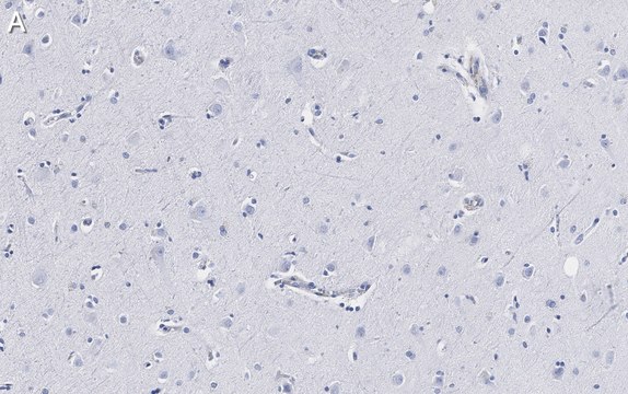Anti-Neurofilament H Antibody, clone 5L10, ZooMAb® Rabbit Monoclonal recombinant, expressed in HEK 293 cells