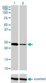 Monoclonal Anti-TWIST1 antibody produced in mouse clone 3E11, purified immunoglobulin, buffered aqueous solution
