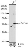 Anti-Phospho-LCK-Y394 antibody produced in rabbit