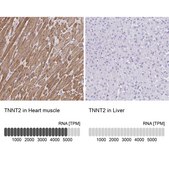 Anti-TNNT2 antibody produced in rabbit Prestige Antibodies® Powered by Atlas Antibodies, affinity isolated antibody, buffered aqueous glycerol solution