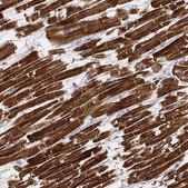 Monoclonal Anti-MYH6 antibody produced in mouse Prestige Antibodies® Powered by Atlas Antibodies, clone CL2155, purified immunoglobulin, buffered aqueous glycerol solution
