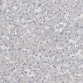 Anti-ADAM2 antibody produced in rabbit Prestige Antibodies® Powered by Atlas Antibodies, affinity isolated antibody, buffered aqueous glycerol solution, Ab2