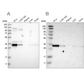 Anti-CASP6 antibody produced in rabbit Prestige Antibodies® Powered by Atlas Antibodies, affinity isolated antibody, buffered aqueous glycerol solution