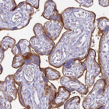 Anti-ALPI antibody produced in rabbit Prestige Antibodies® Powered by Atlas Antibodies, affinity isolated antibody, buffered aqueous glycerol solution