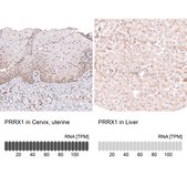 Monoclonal Anti-Prrx1 Antibody Produced In Mouse Prestige Antibodies® Powered by Atlas Antibodies, clone CL14471, affinity isolated antibody, buffered aqueous glycerol solution