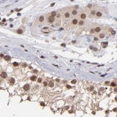 Anti-TERF2 antibody produced in rabbit Prestige Antibodies® Powered by Atlas Antibodies, affinity isolated antibody, buffered aqueous glycerol solution
