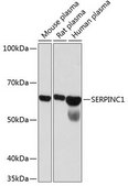 Anti-SERPINC1 antibody produced in rabbit