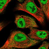 Anti-PRKD2 antibody produced in rabbit Prestige Antibodies® Powered by Atlas Antibodies, affinity isolated antibody