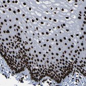 抗-NPM1 兔抗 Prestige Antibodies® Powered by Atlas Antibodies, affinity isolated antibody, buffered aqueous glycerol solution