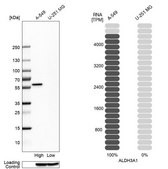 Anti-ALDH3A1 antibody produced in rabbit Prestige Antibodies® Powered by Atlas Antibodies, affinity isolated antibody, buffered aqueous glycerol solution