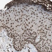 Anti-LMNA antibody produced in rabbit affinity isolated antibody, buffered aqueous glycerol solution