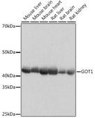 Anti-GOT1 antibody produced in rabbit