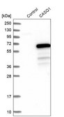Anti-CASQ1 antibody produced in rabbit Prestige Antibodies® Powered by Atlas Antibodies, affinity isolated antibody, buffered aqueous glycerol solution