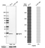 Anti-FABP5 antibody produced in rabbit Prestige Antibodies® Powered by Atlas Antibodies, affinity isolated antibody, buffered aqueous glycerol solution