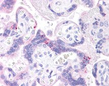 Anti-ABCB1 antibody produced in rabbit affinity isolated antibody