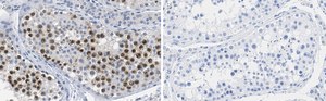 Anti-RAD51 Antibody, clone 1M8 ZooMAb® Rabbit Monoclonal recombinant, expressed in HEK 293 cells