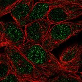 Anti-CA12 antibody produced in rabbit Prestige Antibodies® Powered by Atlas Antibodies, affinity isolated antibody, buffered aqueous glycerol solution