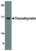 Anti-Transthyretin antibody produced in chicken affinity isolated antibody, buffered aqueous solution