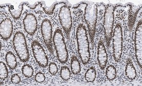 Anti-BRG1 Antibody, clone 1N12, ZooMAb® Rabbit Monoclonal recombinant, expressed in HEK 293 cells